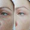 Résultat visible sur les cernes et la texture de peau après application de l’huile